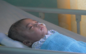 Em bé bị não úng thủy được đưa sang Singapore lần 2 để tiểu phẫu