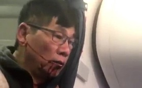 Bác sĩ gốc Việt bị đá khỏi máy bay của United Airlines vẫn nằm viện, thuê hai luật sư để khởi kiện