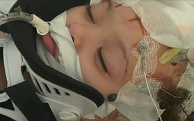 Bé gái 2 tuổi tổn thương não vì bị bảo mẫu là một cậu thiếu niên 16 tuổi trừng phạt