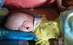 Cuộc sống đau đớn của bé gái 8 tháng tuổi mồ côi cha, cái đầu như muốn "nổ tung" vì căn bệnh não úng thủy