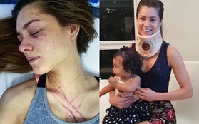 Hoa hậu Venezuela bị nữ ca sĩ đánh trầy mặt, chấn thương khắp người đến mức nhập viện