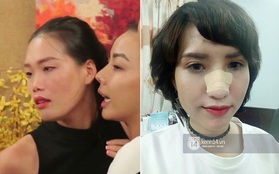 Nghi vấn Nguyễn Hợp - Hồng Xuân tát nhau đến gãy mũi tại "Next Top Model"
