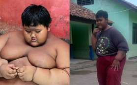Giảm cân ngoạn mục, cậu bé nặng nhất thế giới năm nào giờ đã có cơ thể "nhẹ nhõm" hơn rất nhiều