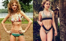 Bị "crush" từ chối vì béo, cô nàng giảm cân tới mức chỉ còn da bọc xương rồi hối hận nhận ra sai lầm của mình