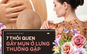 Đừng hỏi vì sao lưng nổi nhiều mụn nếu bạn vẫn giữ những thói quen này