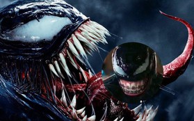 Quá yêu mến gã Venom, netizen Trung "sắm" ngay tặng chàng một bộ niềng răng