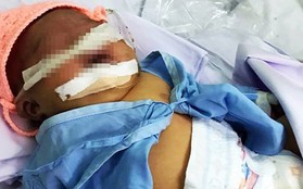 Bé gái nặng 4kg nhưng cho sinh thường ở Bình Thuận bị tổn thương thần kinh cánh tay và hôn mê