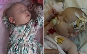 Đang ngủ ngon, sau 1 tiếng bé gái 11 tuần tuổi đã rơi vào tình trạng nguy kịch, cần đến 50 người cấp cứu