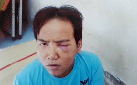 Vụ bảo vệ tổ dân phố sát hại bé trai 6 tuổi ở Sài Gòn: Kẻ gây án bị tâm thần phân liệt thể hoang tưởng