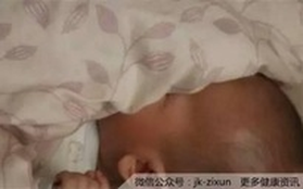 Ủ ấm con quá kín trong chăn, 2 bé sơ sinh phải nhập viện vì ngạt thở đến mức suy kiệt chức năng nội tạng