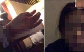 Đau khổ vì chia tay với bạn trai, cô gái trẻ livestream cắt cổ tay tự tử