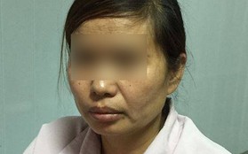 Bắc Giang: Vợ dùng dao chọc tiết lợn đâm chồng tử vong