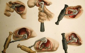 Nhổ răng bằng kìm, răng giả làm từ cao su... và sự thật bảo tàng nha khoa rùng rợn nhất nước Anh có gì?