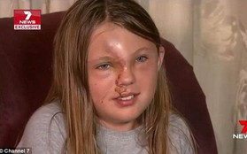 Con gái bất ngờ bị hủy hoại gương mặt sau tai nạn thảm khốc, mẹ tuyệt vọng mong tìm ra kẻ thủ ác