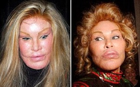 Cuộc đời tai tiếng của “miêu nữ” tỷ phú Jocelyn Wildenstein: Chi núi tiền phẫu thuật giống mèo để chiều chồng, cuối cùng nhận về kết cục đắng ngắt