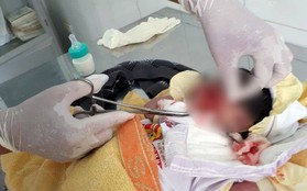 Bình Thuận: Hoảng hồn phát hiện một bé sơ sinh nghi bị chôn sống, còn dây rốn
