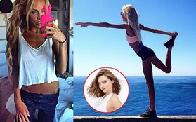 Quá hâm mộ Miranda Kerr, cô gái trẻ suýt chết vì nhịn ăn với mong muốn sở hữu được thân hình hoàn hảo như siêu mẫu