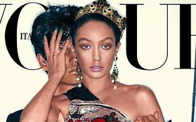 Dính "thảm họa photoshop", Gigi Hadid đang xinh đẹp bỗng kém sắc đến khó nhận ra