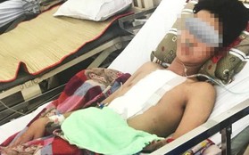Nửa đêm, chàng trai 19 tuổi ở TP.HCM bị đâm thủng tim, phổi được cứu sống