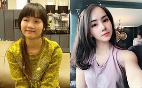 Từng bị bạn bè cầm chổi ném vì xấu xí, cô gái Hà Nội hở hàm ếch lột xác, đổi đời sau phẫu thuật thẩm mỹ