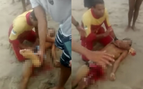 Đi bơi tại vùng biển có cảnh báo nguy hiểm, thanh niên Brazil bị cá mập cắn đứt "của quý"