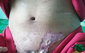 Vụ cô gái nghi bị tra tấn dã man: Sau nửa tháng đánh đập, nạn nhân phát hiện bị sẩy thai