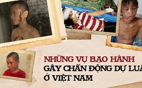 Từ sự việc Nga "vọc" bạo hành người giúp việc đến sảy thai, nhìn lại những vụ tra tấn dã man từng chấn động dư luận cả nước