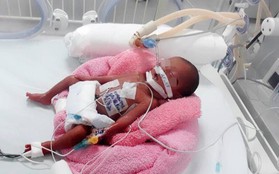 TP.HCM: Bé gái sơ sinh nặng chỉ 600 gram, tổn thương tim nguy kịch được cứu sống "thần kỳ"