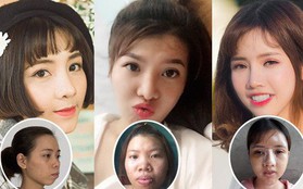 3 cô nàng "đập mặt đi xây lại” gây bão MXH: Nhờ những phương pháp dao kéo này mà nhan sắc “một bước lên hương”