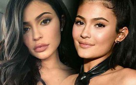 Bơm hay không bơm nói một lời là điều dân tình thắc mắc về đôi môi "gây lú" của Kylie Jenner