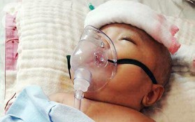 Mẹ trẻ đau đớn cầu xin mạnh thường quân cứu con trai bị não úng thủy từ lúc 2 tháng tuổi