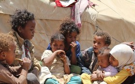 Liên Hợp Quốc “thua cuộc” trong cuộc chiến chống nạn đói tại Yemen