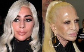 Mặt cứng đơ kém sắc, Lady Gaga bị nghi lạm dụng thẩm mỹ giống "thảm họa dao kéo" Donatella Versace