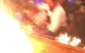 Nhà hàng biểu diễn quá tay, lửa táp thực khách bỏng nặng