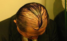 Tuyển tập 14 mẫu tóc che mưa dành cho các quý ông đầu hói
