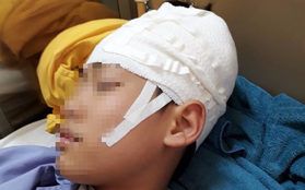 Quảng Ninh: Nam sinh lớp 9 nhập viện, "nghi" bị thầy giáo tát khiến tụ máu ở đầu