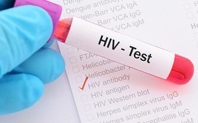 Phát hiện cơ chế giúp chữa khỏi HIV ngay trong não người