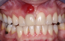 5 dấu hiệu bất thường ở vùng răng miệng có thể dự báo nhiều căn bệnh nguy hiểm mà bạn không lường trước được