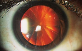Bệnh nhân với con mắt siêu hiếm trông như bánh pizza 8 miếng: Minh chứng cho thấy y học đã từng đáng sợ như thế nào