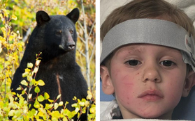 Bé 3 tuổi lạc trong rừng mưa lạnh suốt 2 ngày, khi được tìm thấy cậu nói "đã đi chơi với gấu" và mọi người tin câu chuyện này