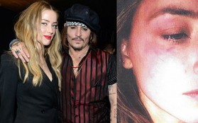 Amber Heard tố Johnny Depp hành hung cô "như một con quái vật" nhưng nam tài tử đáp lại bằng một điều bất ngờ