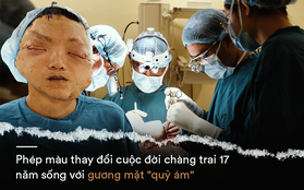 Phép màu thay đổi cuộc đời chàng trai 17 năm sống với gương mặt "quỷ ám": Tôi không phải cúi mặt khi gặp người lạ nữa rồi