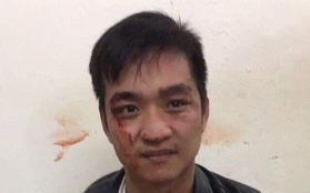 Hà Nội: Cướp tiệm vàng, nam thanh niên bị công an tóm gọn