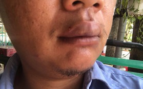 Phóng viên Đài Tiếng nói Việt Nam bị giang hồ đánh uy hiếp ở Sài Gòn