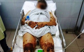 Vụ nam Việt kiều bị tạt axit, cắt gân chân khi về quê ăn Tết: Anh trai nạn nhân vội vã rời khỏi Việt Nam không rõ lý do