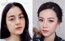 Beauty Center: Địa chỉ thực hiện Vline Perfect - Thon gọn mặt không phẫu thuật hàng đầu Việt Nam