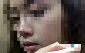 Nữ sinh viên bị cưỡng hôn trong thang máy lên tiếng sau khi làm việc với công an