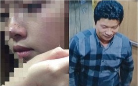 Nữ sinh bị cưỡng hôn trong thang máy: "Tôi thấy thất vọng, phạt 200.000 đồng quá nhẹ nhàng"