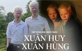 Hai anh em bạch tạng ở Hà Tĩnh từng gây cảm xúc trong bộ ảnh "Twins" vào 6 năm trước giờ ra sao?