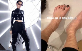 Nhìn chân Khánh Linh sau khi đi Tuần lễ thời trang để thấy, làm fashionista chẳng hề đơn giản